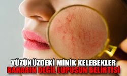 YÜZÜNÜZDEKİ MİNİK KELEBEKLER BAHARIN DEĞİL LUPUSUN BELİRTİSİ