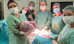 Karnından çıkan şey doktorları dehşete düşürdü