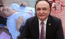 Yeni Partili milletvekili bıçaklı saldırıya uğradı
