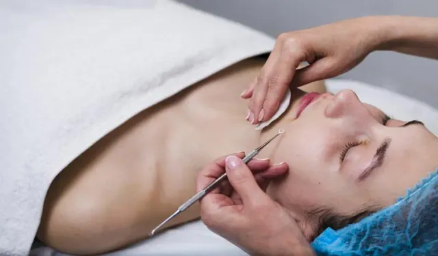 Masseter Botoks İstanbul Hakkında En Çok Sorulan 10 Soru
