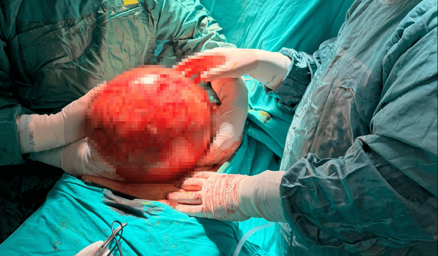 Doktorlar gözlerine inanamadı: karnından dev kitle çıktı