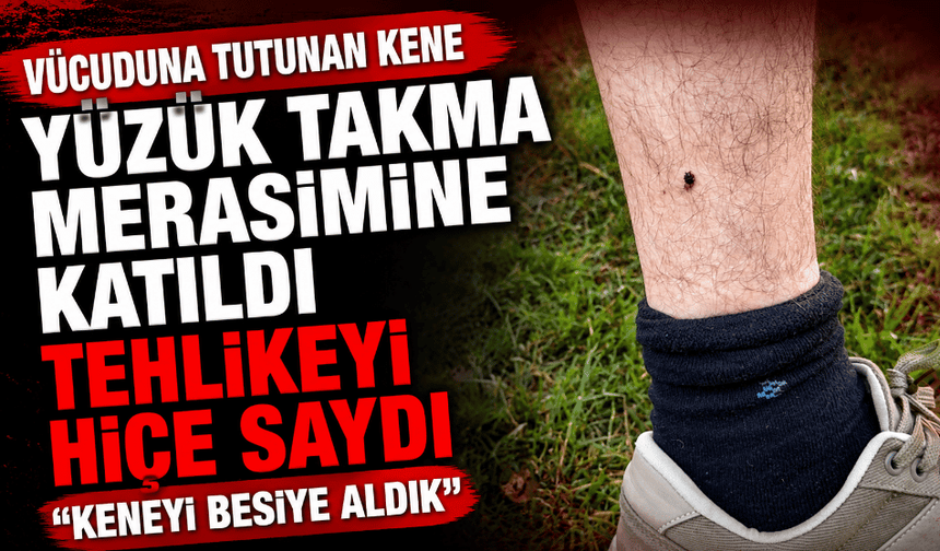 Vücuduna tutunan kene yüzük takma merasimine katıldı, tehlikeyi hiçe saydı "Keneyi besiye aldık"