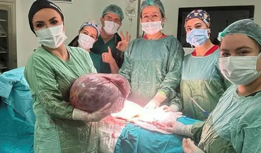 Karnından çıkan şey doktorları dehşete düşürdü