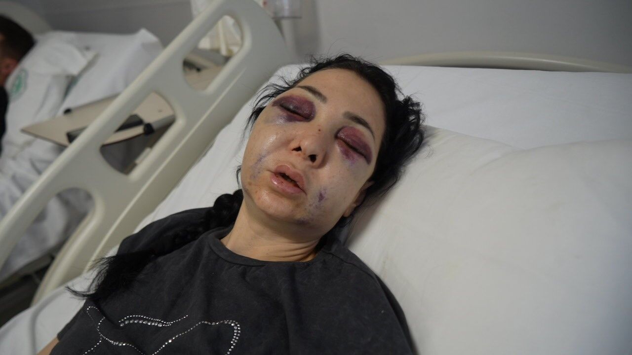 Oğlunun Önünde Darp Ettiler (2)