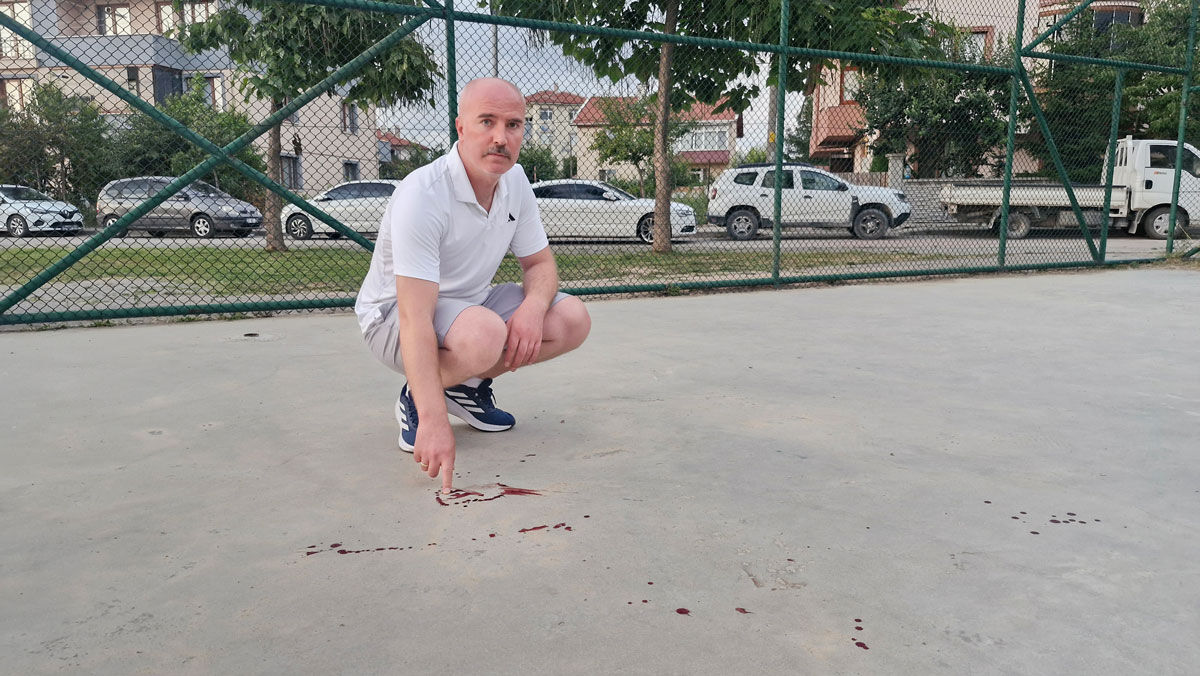 Bolu Küçük Çocuk Yaralanma (1)